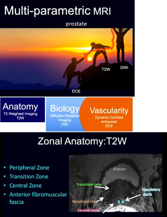 mpMRI.prostate.webp